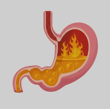 Acidic Stomach