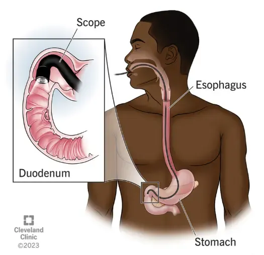 High-resolution view of an upper endoscopy procedure inspecting the gastrointestinal tract