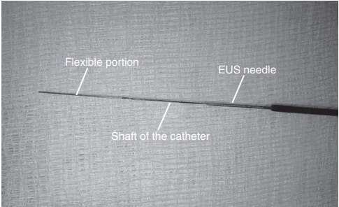 EUS-Guided Ablation Therapy and Celiac Plexus Interventions for Pain Management and Cancer Treatment