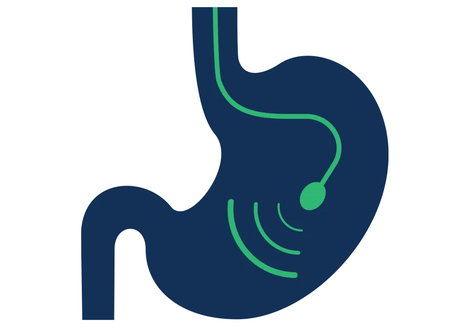 Diagnostic Endoscopic Ultrasound scanning internal GI wall layers