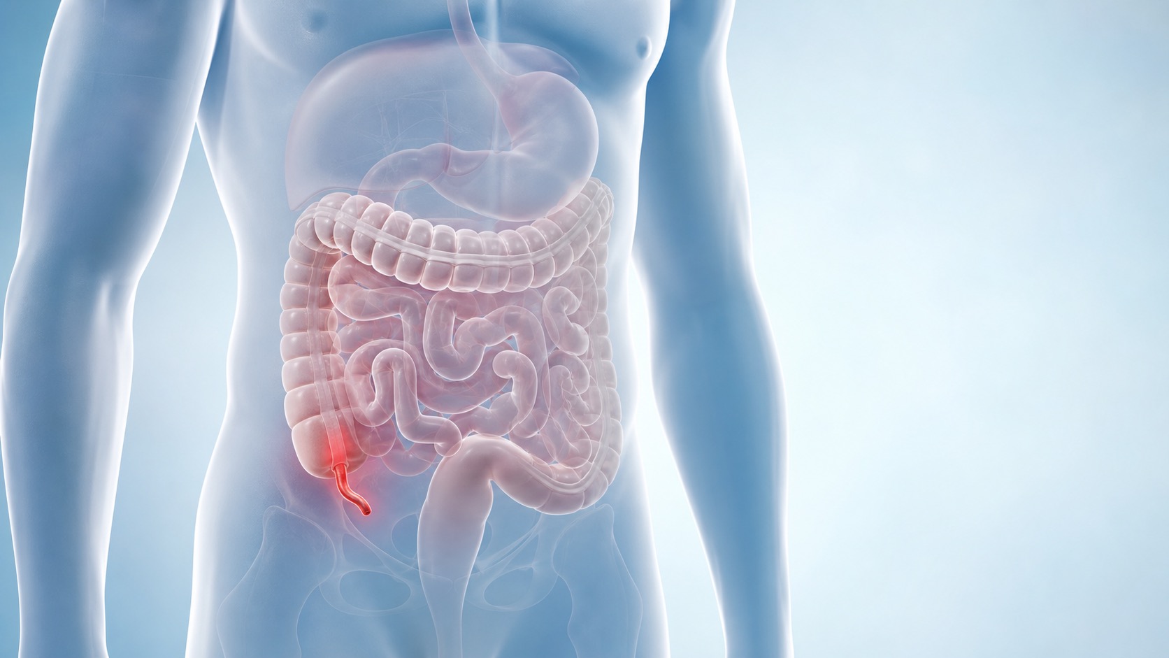 Appendix Ki Alamat: Appendicitis Symptoms