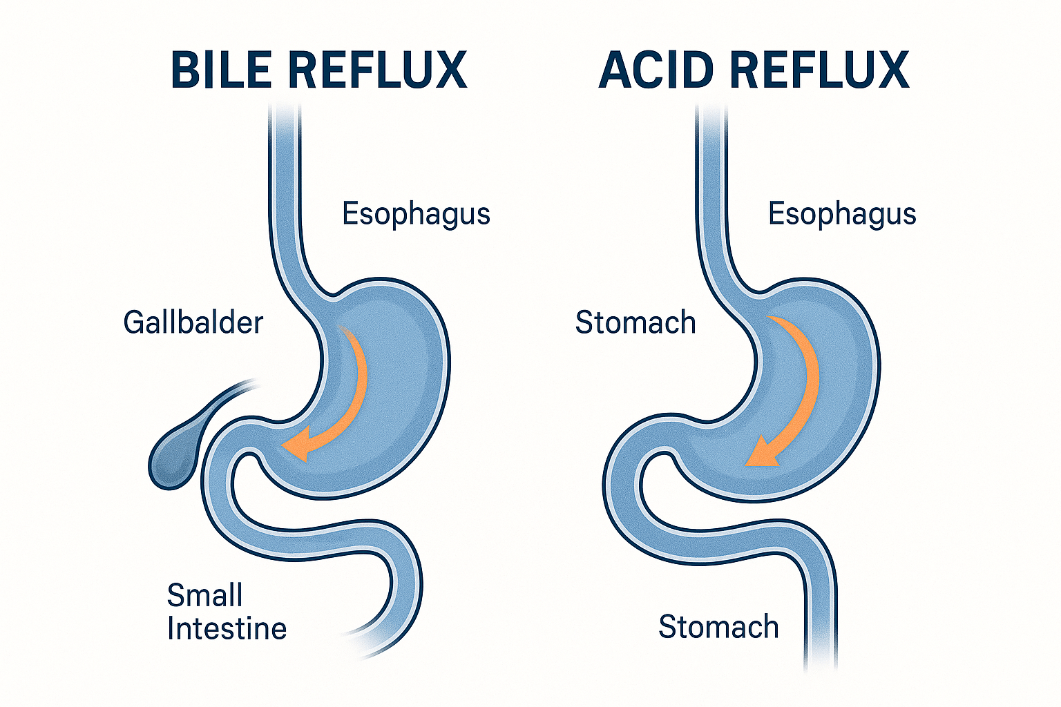 Gallbladder Related Reflux Treatment | Dr. Ali Taj Karachi