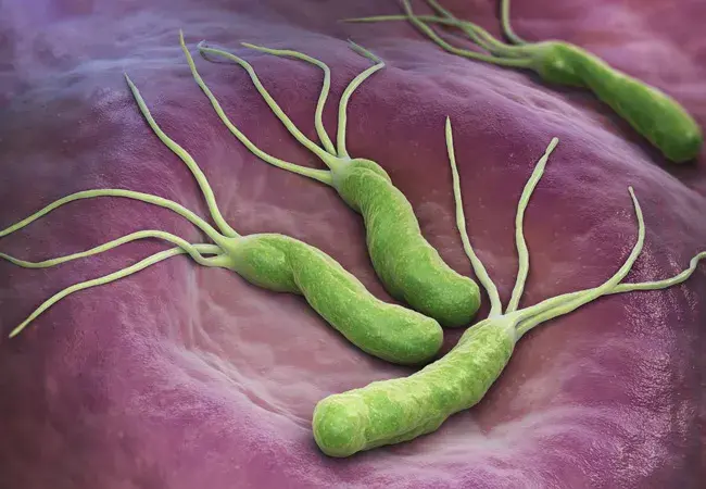 H. Pylori Ka Ilaj in Urdu - Complete Treatment Guide & Diet Plan